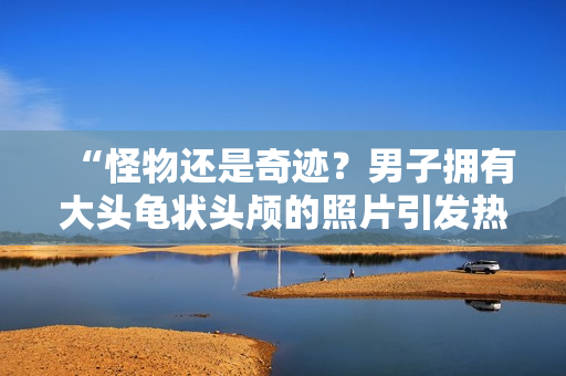 “怪物还是奇迹？男子拥有大头龟状头颅的照片引发热议”