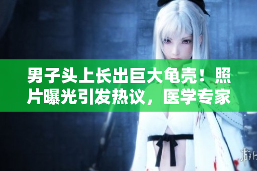 男子头上长出巨大龟壳！照片曝光引发热议，医学专家解读其病因与治疗方案